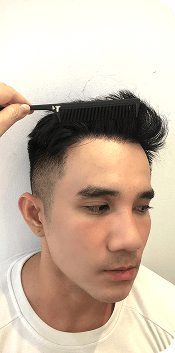 Cấy ghép tóc Y học Quốc Tế