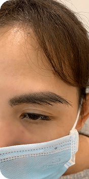 Cấy ghép tóc Y học Quốc Tế