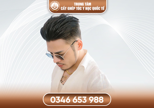 Công Nghệ Cấy Râu Thẩm Mỹ : Giải Pháp Khắc Phục Tình Trạng Râu Thưa, Râu Mọc Không Đều