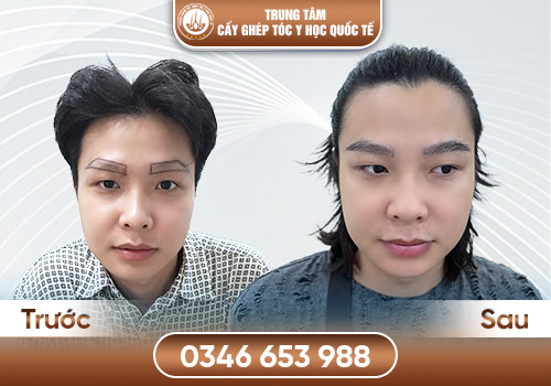 Lựa chọn địa chỉ cấy lông mày uy tín để sở hữu dáng mày tự nhiên