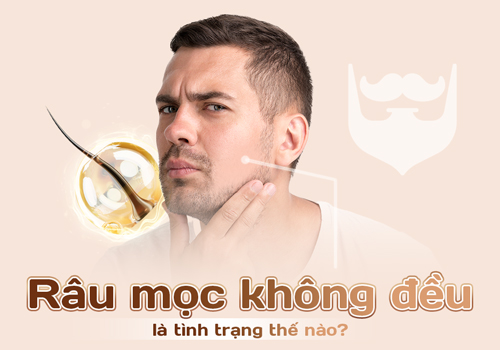 râu mọc không đều