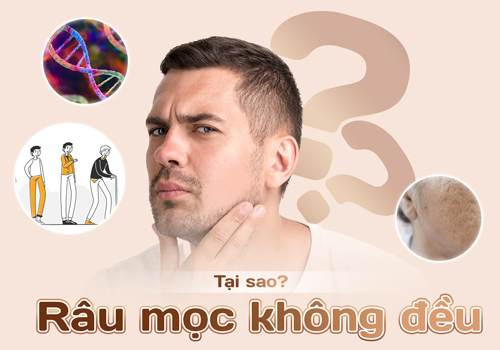 Tại sao râu mọc không đều