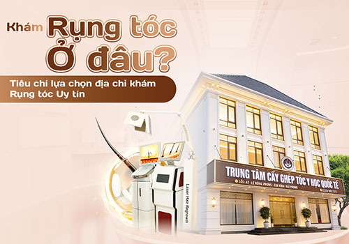 Khám rụng tóc ở đâu? Tiêu chí lựa chọn địa chỉ khám rụng tóc uy tín