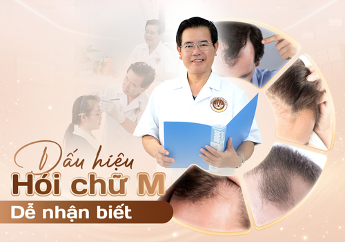 Hói chữ M là gì? Dấu hiệu nguyên nhân và cách trị hói chữ M hiệu quả